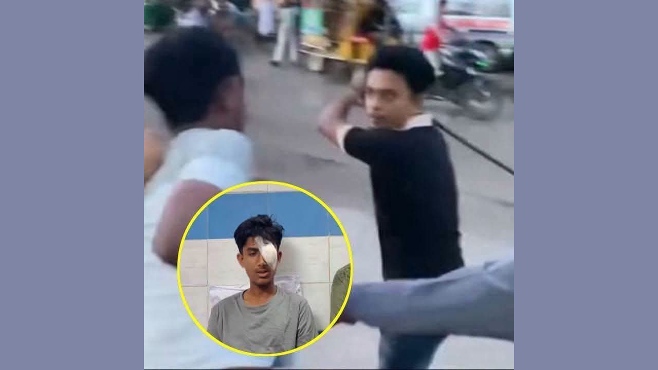 হবিগঞ্জে এনসিপি কর্মী আলিফের চোখে হামলাকারী ছাত্রদল নেতার পরিচয় পাওয়া গেছে